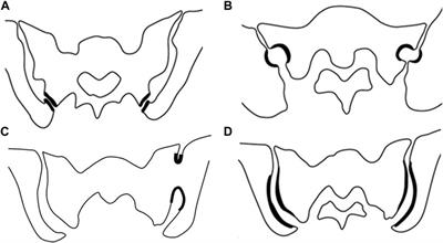 Novel insights into the anatomy and histopathology of the sacroiliac joint and correlations with imaging signs of sacroiliitis in case of axial spondyloarthritis